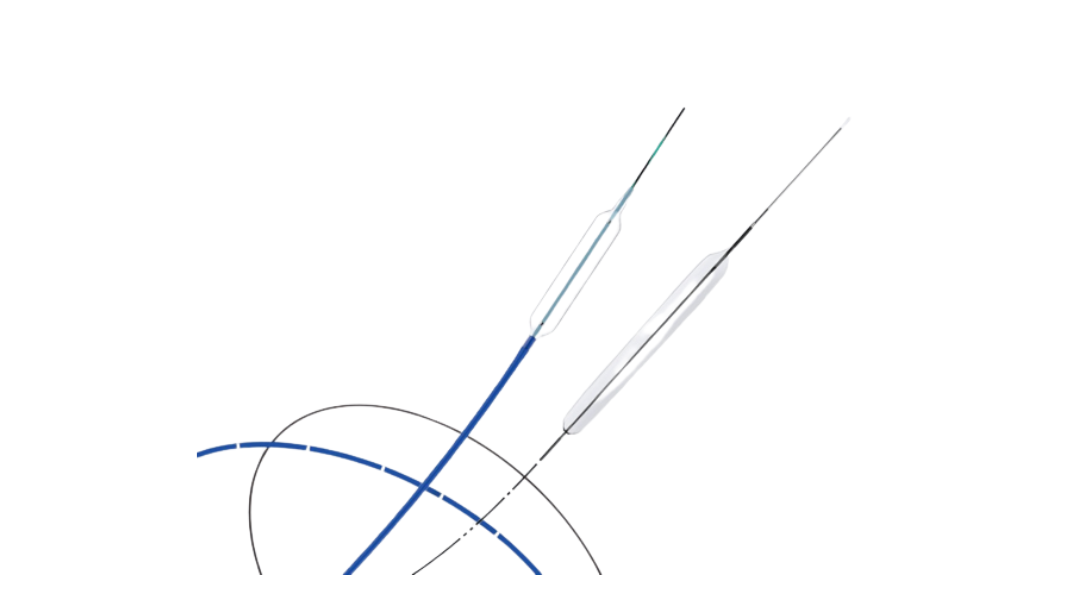 Ureteral dilation balloon catheter - N range